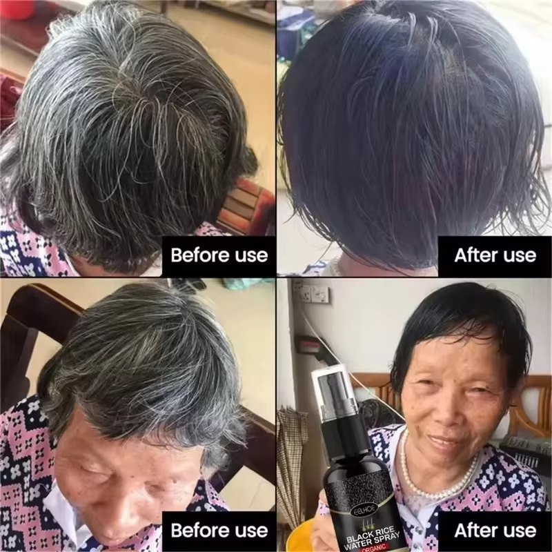 Gray White Hair Treatment Seru - Hair Care Ginseng review and price