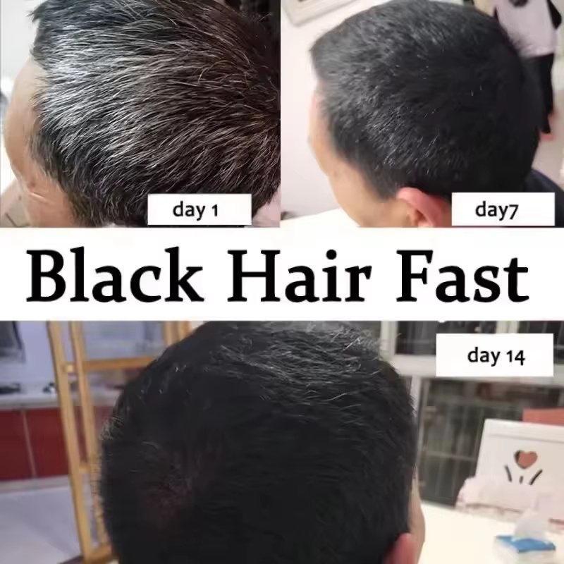 Gray White Hair Treatment Seru - Hair Care Ginseng review and price