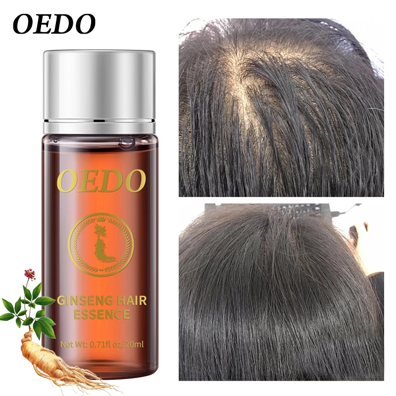 20ML Ginseng Hair Growth Essen - Hair Care Ginseng review and price
