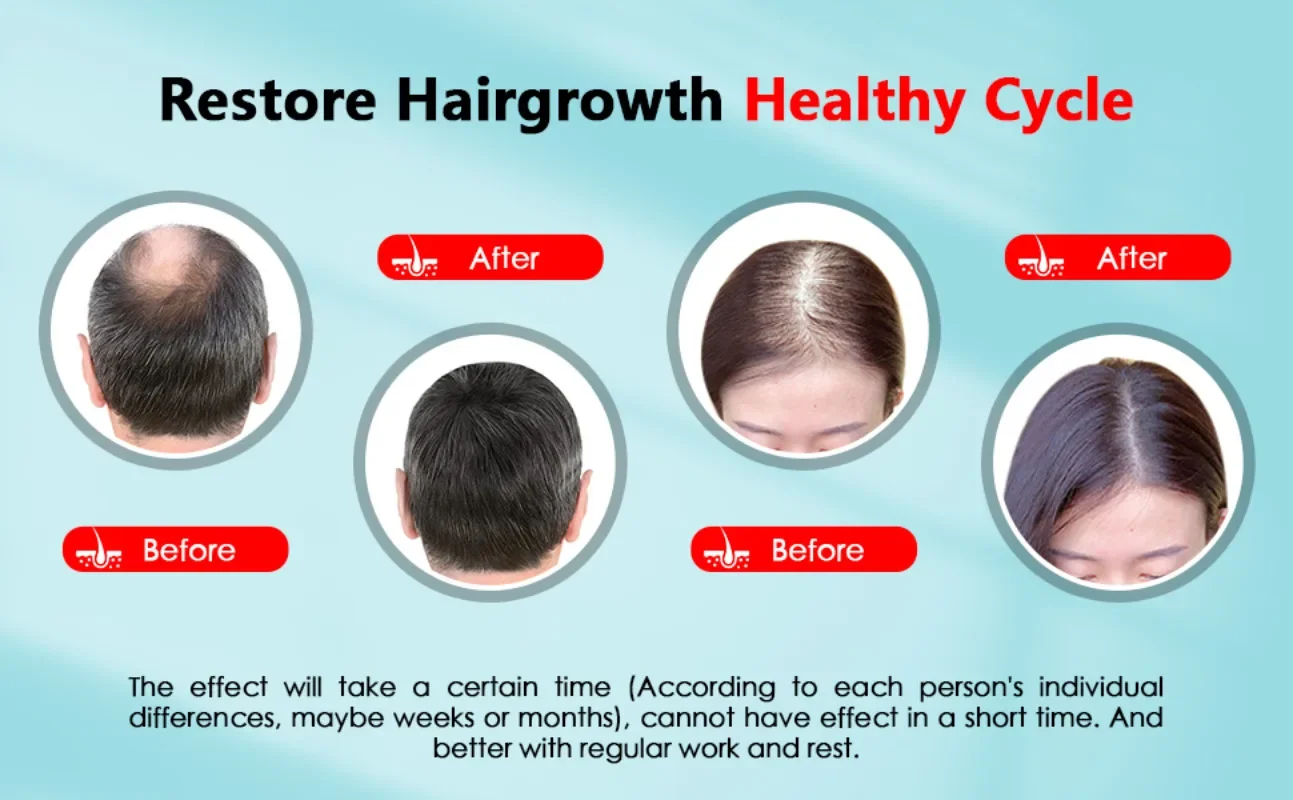 Hair Growth Cap Rechargeable 2 - Hair Care Vegan review and price
