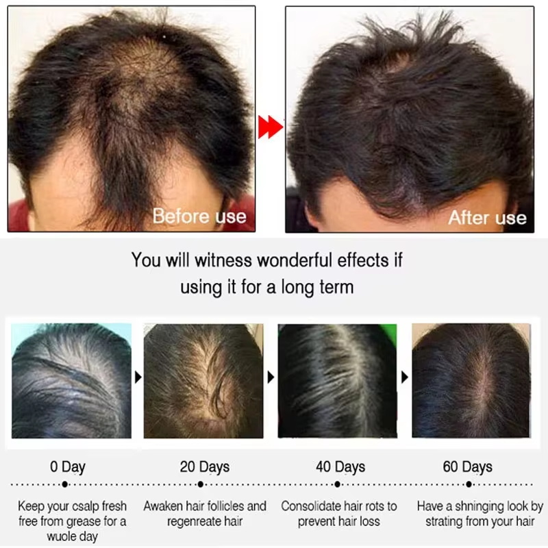 Fast Ginger Hair Growth Spray  - Hair Care Tonic review and price